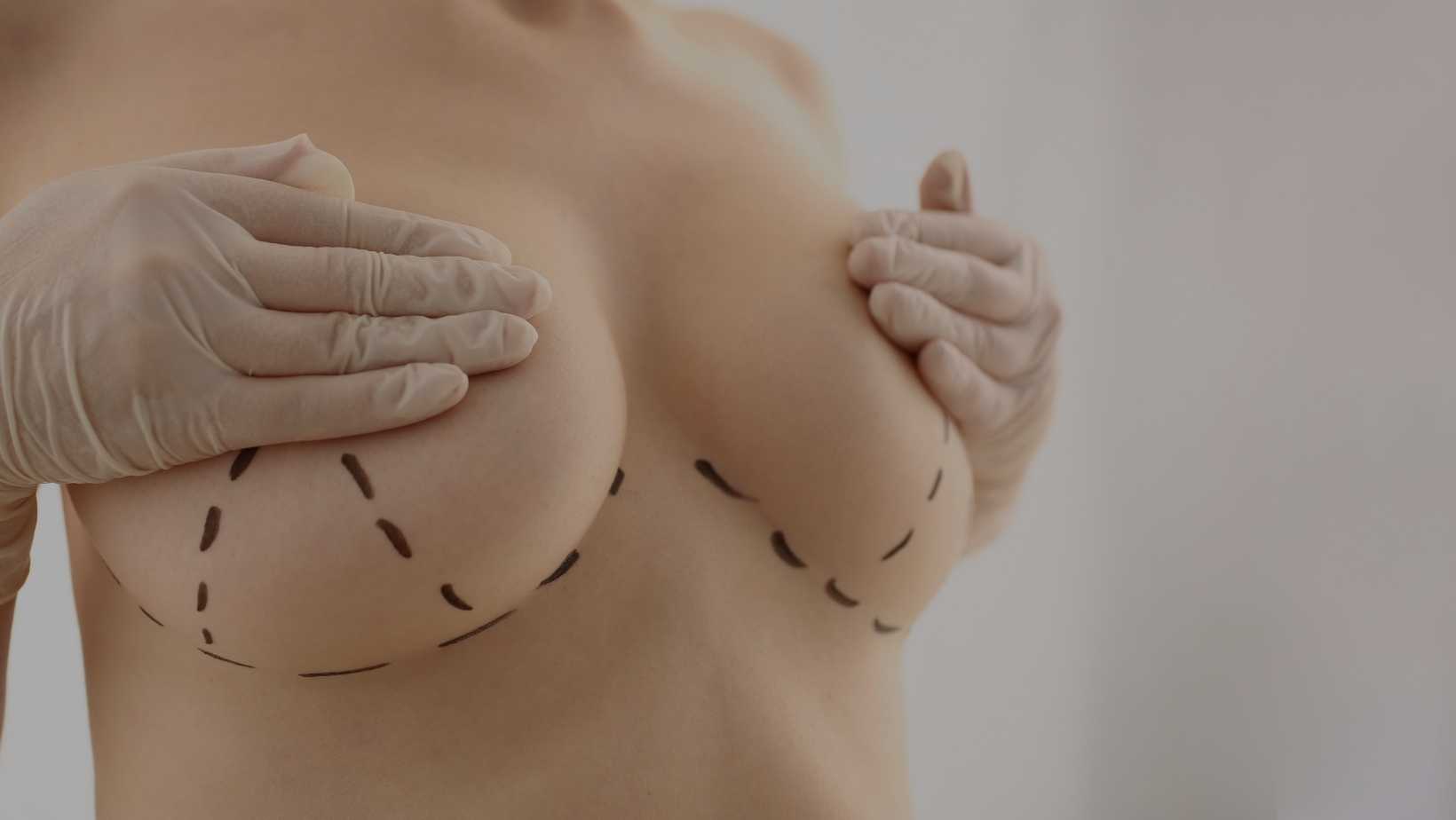 Remedy for Chest Asymmetry Disorder